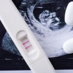 ¿Cuántos días después de la regla se puede quedar embarazada? cuantos-dias-despues-de-la-regla-se-puede-quedar-embarazada